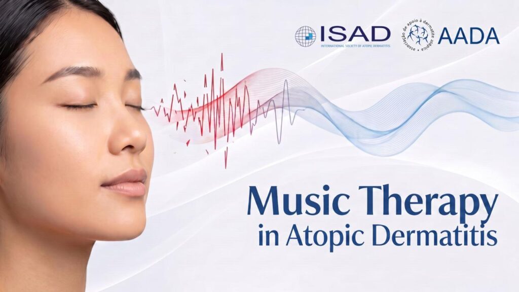 music therapy